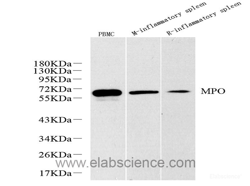 Western blot analysis of extracts of various cell lines using LRP5 Polyclonal Antibody at dilution of 1:1000.