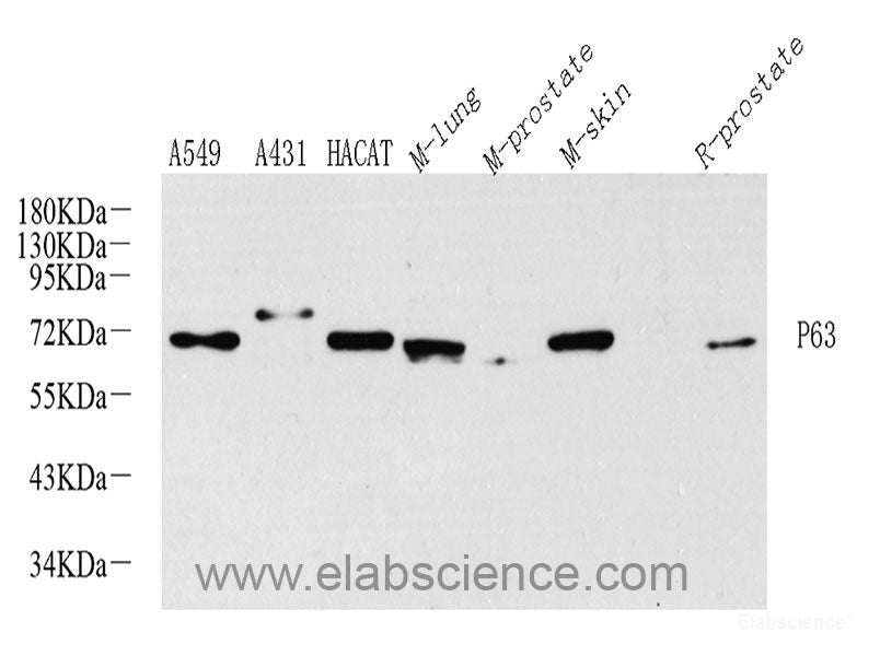 Western blot analysis of extracts of various cell lines using UCHL1 Polyclonal Antibody at dilution of 1:1000.