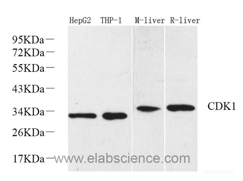 Immunohistochemistry of paraffin-embedded Human stomach using HDAC4 Polyclonal Antibody at dilution of 1:100 (40x lens).