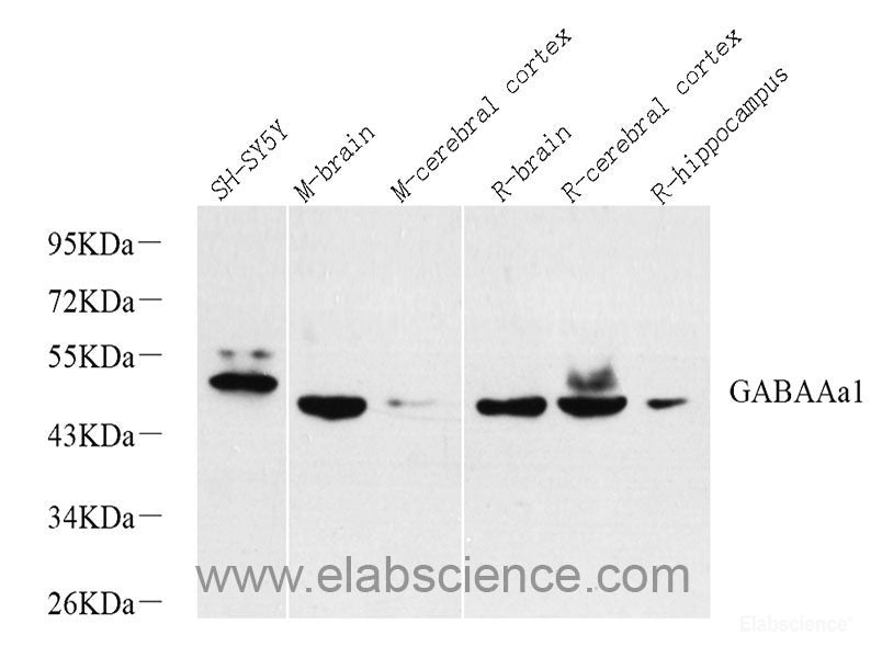 Western blot analysis of extracts of HeLa cells using ATF4 Polyclonal Antibody at dilution of 1:1000. HeLa cells were treated by tunicamycin (2 μg/ml) for 8 hours.