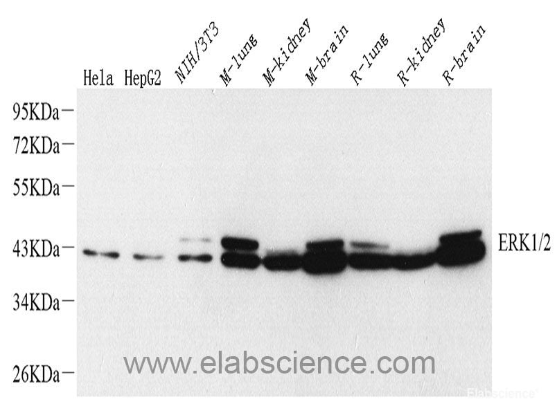 Western blot analysis of extracts of various cell lines using BAK1 Polyclonal Antibody at dilution of 1:1000.