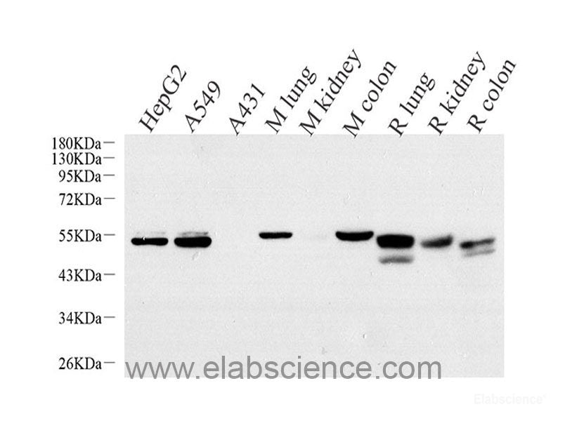 Western blot analysis of extracts of HL-60 cells using Bcl-2 Polyclonal Antibody at dilution of 1:500.