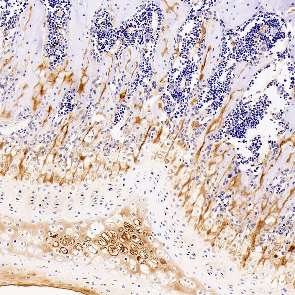 Immunohistochemistry of paraffin-embedded Rat kidney using BCL2L1 Polyclonal Antibody at dilution of 1:100 (40x lens).