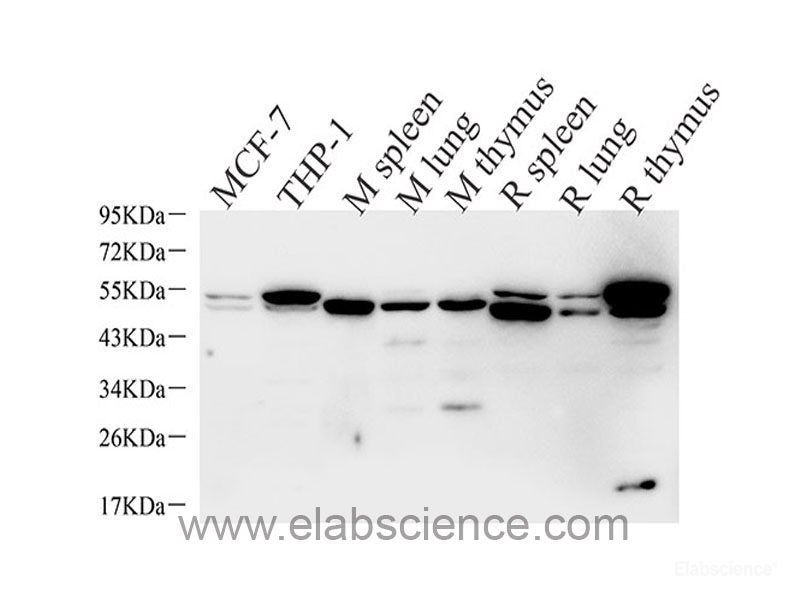 Immunohistochemistry of paraffin-embedded Mouse brain using BRCA1 Polyclonal Antibody at dilution of 1:100 (40x lens).