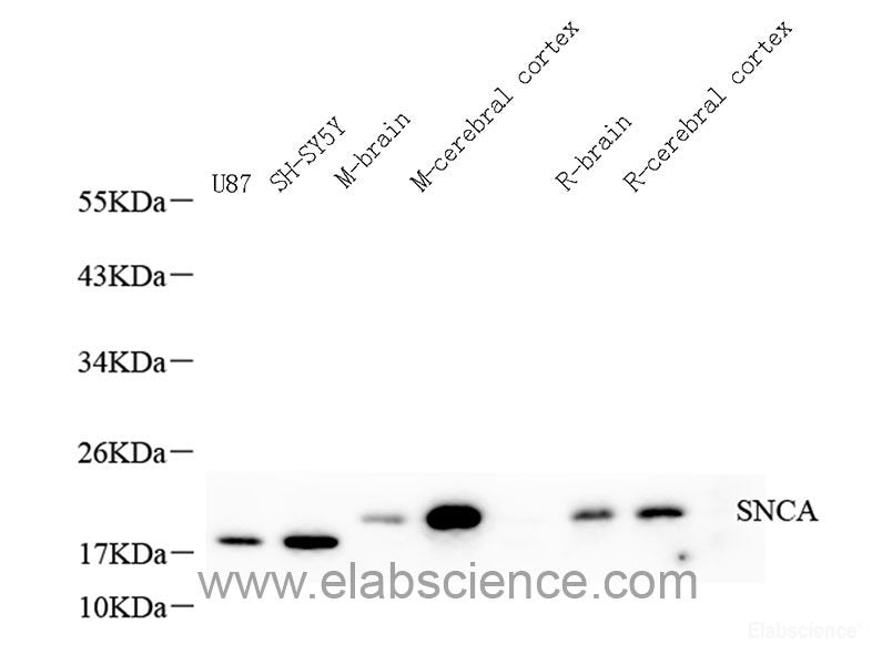 Western blot analysis of extracts of various cell lines using Caspase-8 Polyclonal Antibody at dilution of 1:1000.