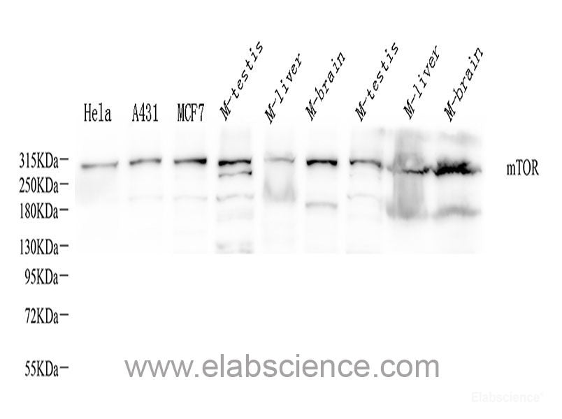 Western blot analysis of extracts of various cell lines using CD133 Polyclonal Antibody at dilution of 1:1000.