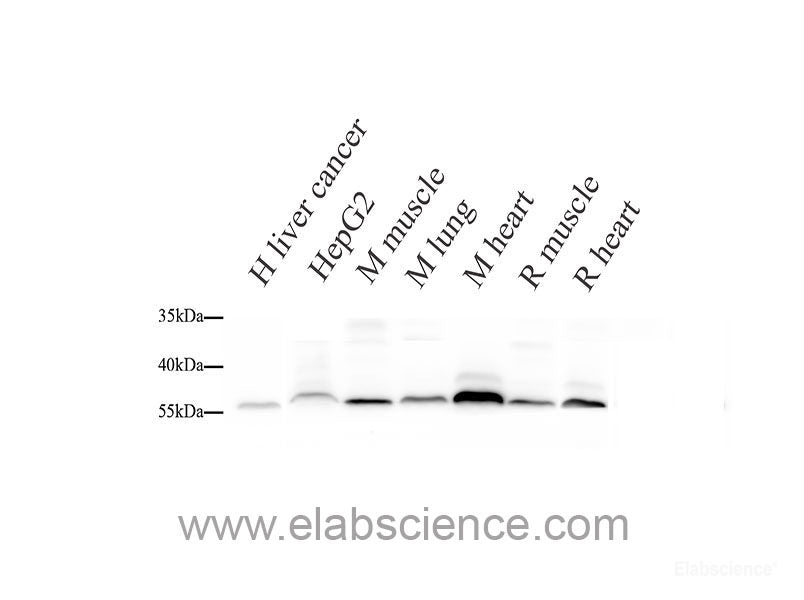Western blot analysis of extracts of various cell lines using FABP4 Polyclonal Antibody.