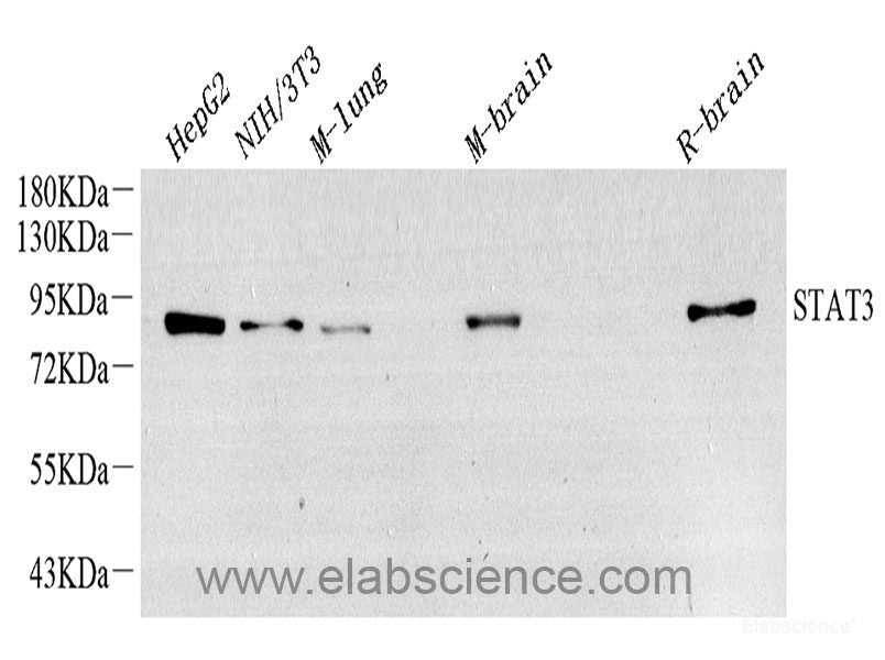 Western blot analysis of extracts of Rat ovary using FGF2 Polyclonal Antibody at dilution of 1:1000.