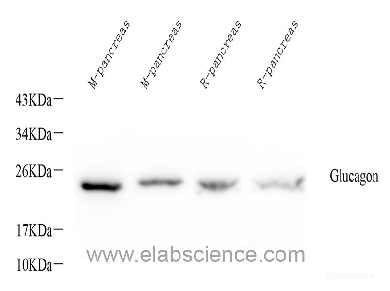Immunohistochemistry of paraffin-embedded Rat brain using GRP78 / BiP Polyclonal Antibody at dilution of 1:100 (40x lens).