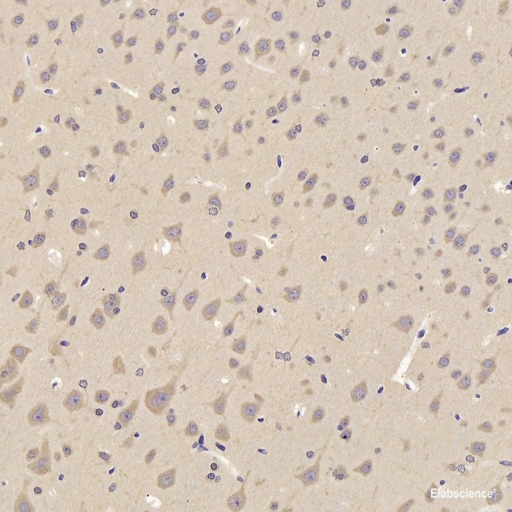 Immunohistochemistry of paraffin-embedded Mouse liver using IGF1R Polyclonal Antibody at dilution of 1:100 (40x lens).