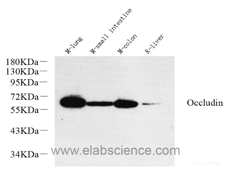Western blot analysis of extracts of various cell lines using IKBKE Polyclonal Antibody.
