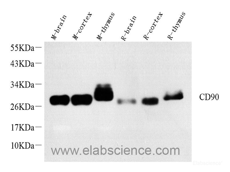 Western blot analysis of extracts of Mouse stomach using KRT19 Polyclonal Antibody at dilution of 1:1000.