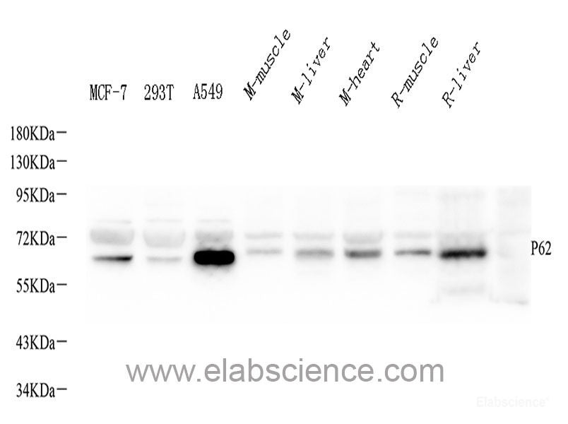 Western blot analysis of extracts of various cell lines using Lamin A/C Polyclonal Antibody at dilution of 1:1000. HeLa cells were treated by Hydroxyurea (4 mM) at 37°C for 20 hours or treated by Paclitaxel (100 nM/ml) at 37°C for 20 hours. C6 cells were treated by Hydroxyurea (4 mM) at 37°C for 20 hours or treated by Paclitaxel (100 nM) at 37°C for 20 hours.