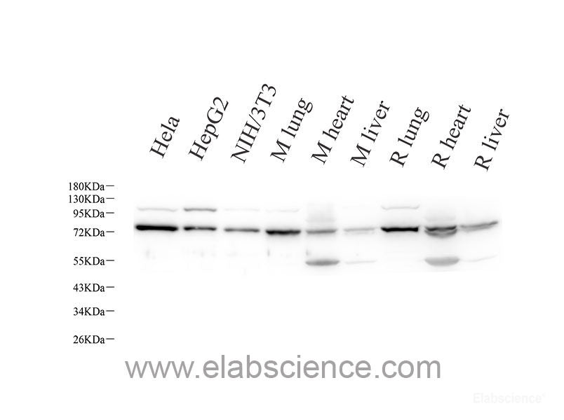 Immunohistochemistry of paraffin-embedded Human lung cancer using MCL1 Polyclonal Antibody at dilution of 1:100 (40x lens).
