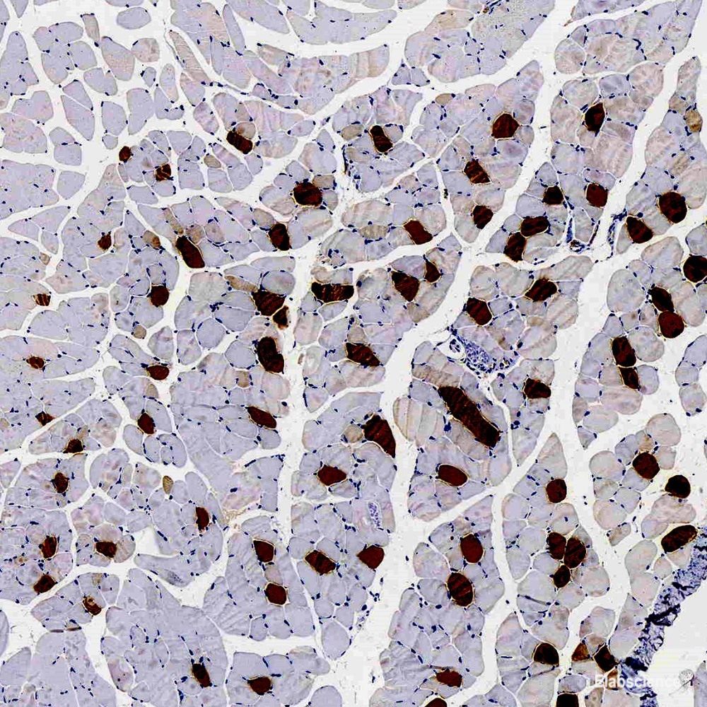 Western blot analysis of extracts of Mouse brain using MAP2K2 Polyclonal Antibody.