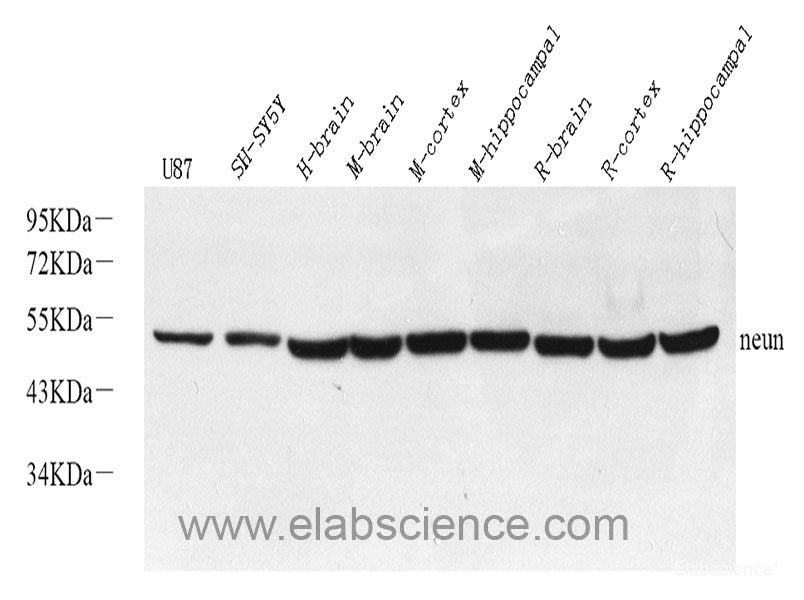 Immunohistochemistry of paraffin-embedded Rat heart using NME1 Polyclonal Antibody at dilution of 1:200 (40x lens).