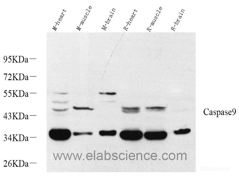 Western blot analysis of extracts of various cell lines using NUDT6 Polyclonal Antibody at dilution of 1:1000.