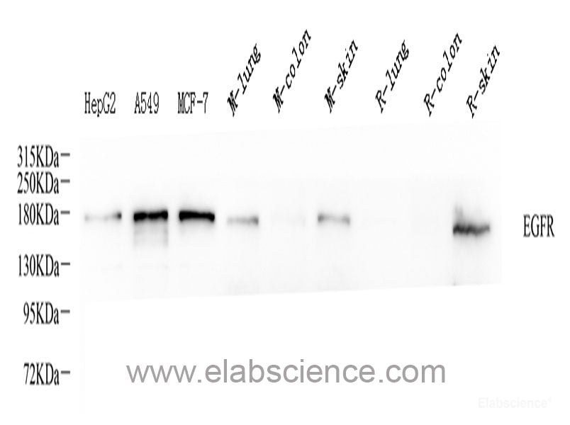 Western blot analysis of extracts of various cell lines using OLFM1 Polyclonal Antibody at dilution of 1:1000.