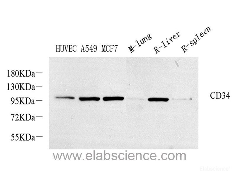 Western blot analysis of extracts of various cell lines using p53 Polyclonal Antibody at dilution of 1:1000.