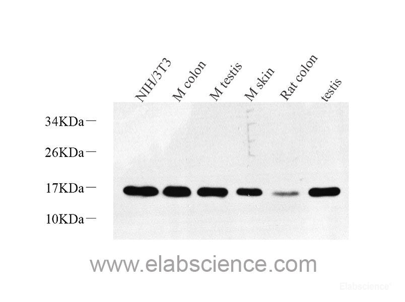 Western blot analysis of extracts of various cell lines using PCNA Polyclonal Antibody at dilution of 1:1000.
