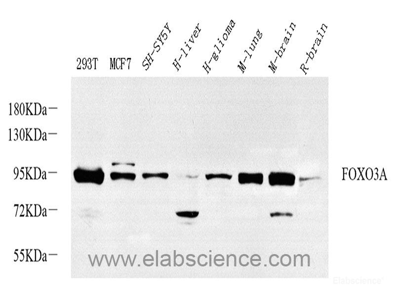 Western blot analysis of extracts of various cell lines using PRKCA Polyclonal Antibody.