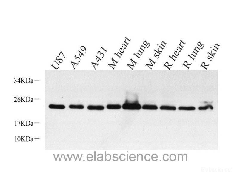 Immunohistochemistry of paraffin-embedded Rat ovary using SIRT2 Polyclonal Antibody at dilution of 1:100 (40x lens).