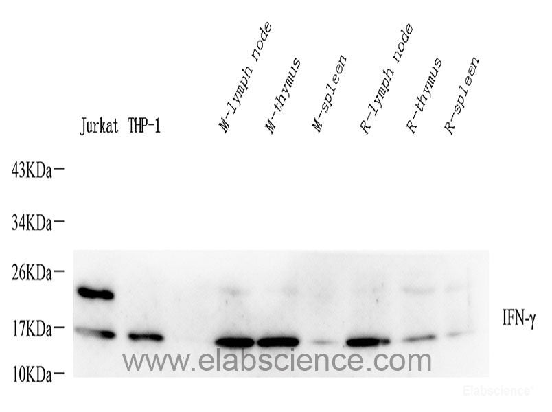 Western blot analysis of extracts of HeLa cells using ABL1 Polyclonal Antibody at dilution of 1:1000.