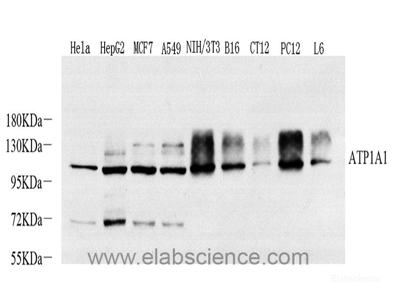 Immunofluorescence analysis of A549 cells using IFNA1 Polyclonal Antibody