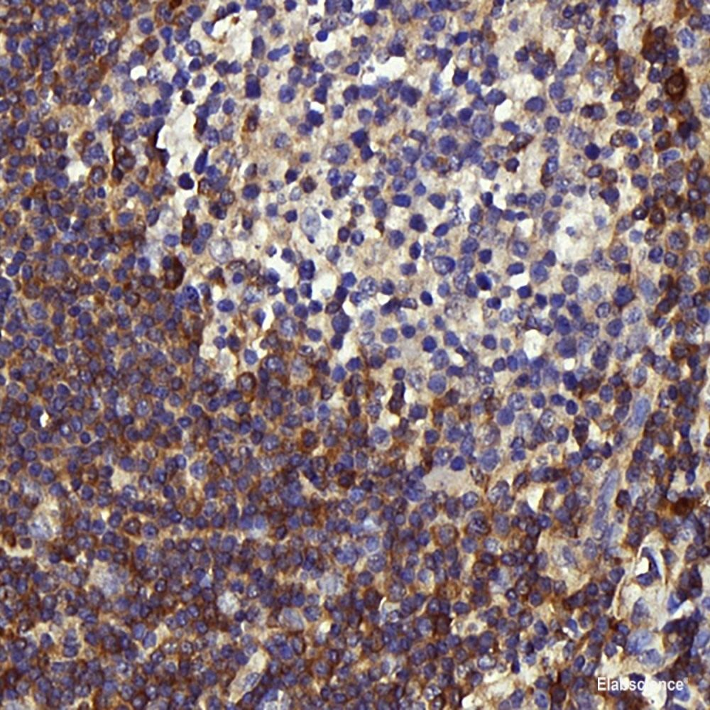 Western blot analysis of extracts of various cell lines using JNK1 Polyclonal Antibody at dilution of 1:1000.