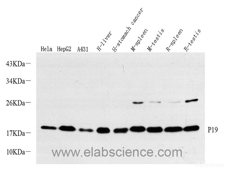 Immunohistochemistry of paraffin-embedded Rat brain using CDKN1B Polyclonal Antibody at dilution of 1:200 (40x lens).