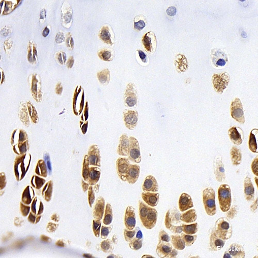 Western blot analysis of extracts of various cell lines using Estrogen Receptor alpha Polyclonal Antibody at dilution of 1:1000.