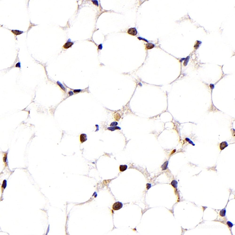 Immunohistochemistry of paraffin-embedded Rat brain using IGF1 Polyclonal Antibody at dilution of 1:100 (40x lens).