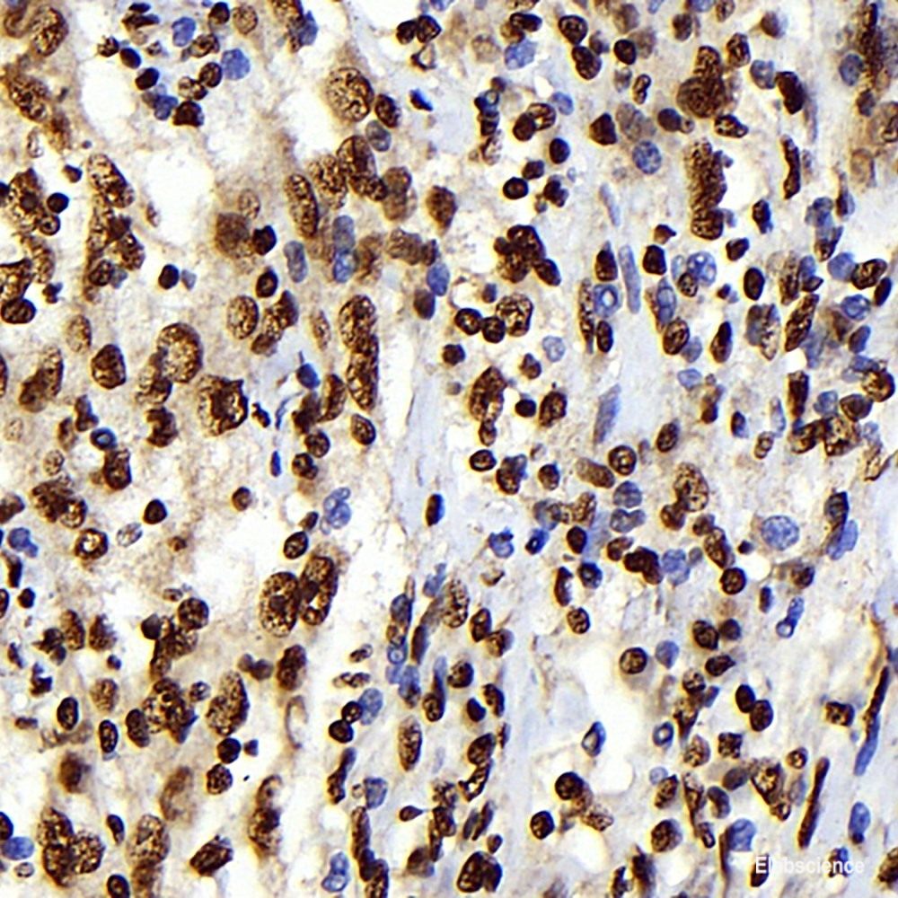 Immunohistochemistry of paraffin-embedded Human prostate using APOE Polyclonal Antibody at dilution of 1:100 (40x lens).