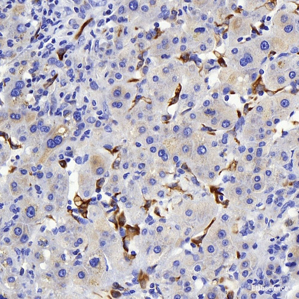 Immunohistochemistry of paraffin-embedded Human uterus using PGR Polyclonal Antibody at dilution of 1:100 (40x lens).