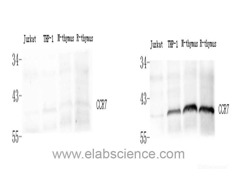 Immunohistochemistry of paraffin-embedded Human tonsil using CD44 Polyclonal Antibody at dilution of 1:200 (40x lens).