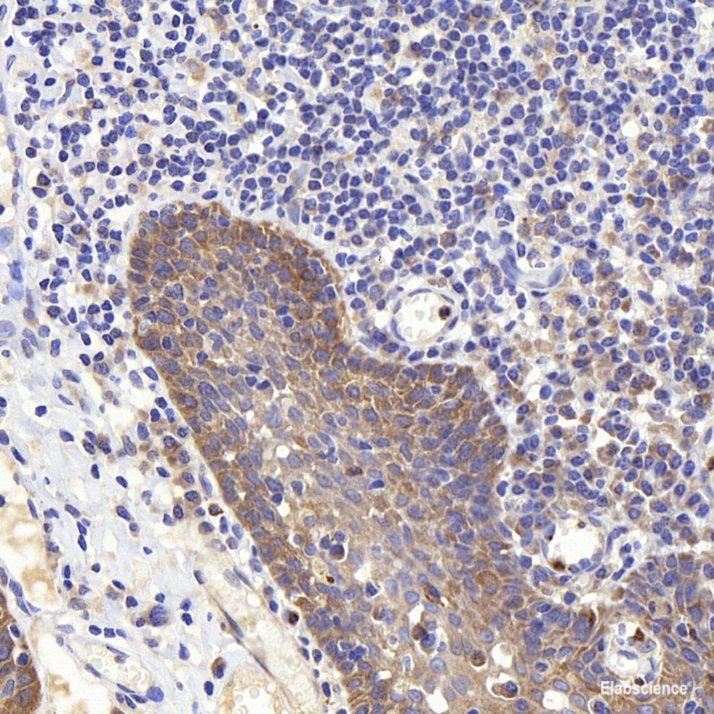 Immunohistochemistry of paraffin-embedded Human colon using CDK4 Polyclonal Antibody at dilution of 1:100 (40x lens).