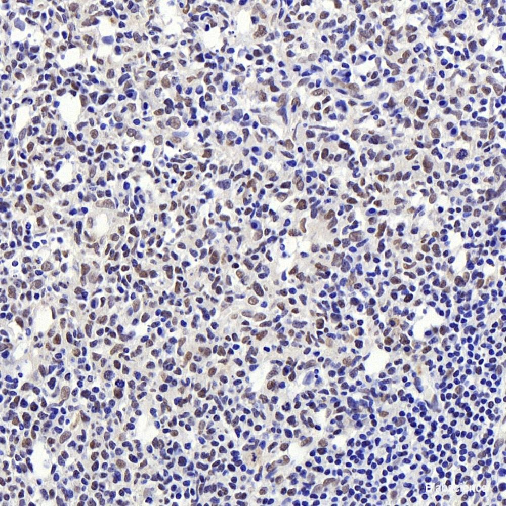 Immunohistochemistry of paraffin-embedded Rat ovary using VHL Polyclonal Antibody at dilution of 1:200 (40x lens).