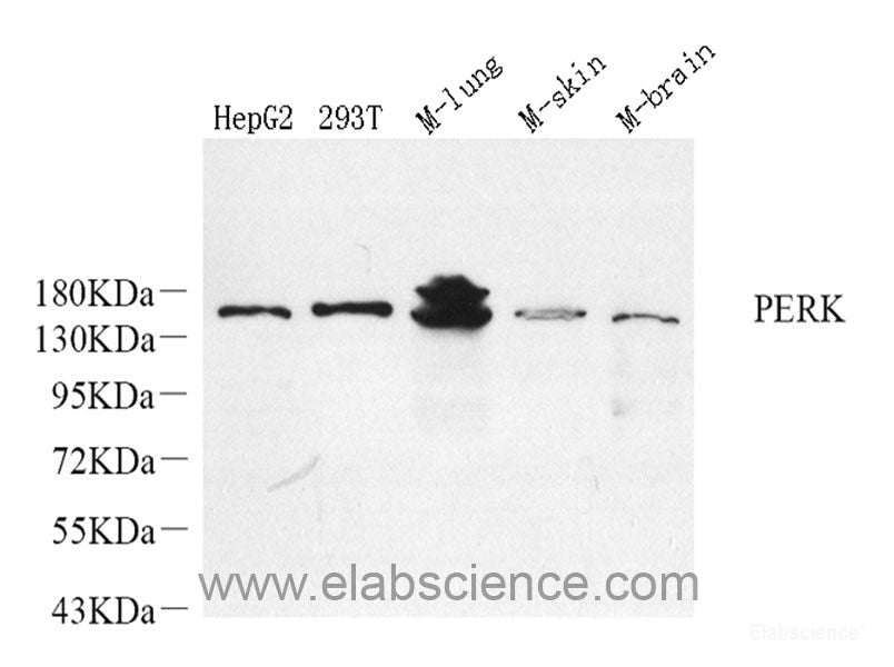 Western blot analysis of extracts of 293T cells using TP73 Polyclonal Antibody at dilution of 1:1000.