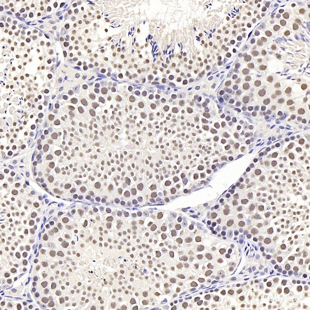 Immunohistochemistry of paraffin-embedded Rat heart using N-Cadherin Polyclonal Antibody at dilution of 1:100 (40x lens).