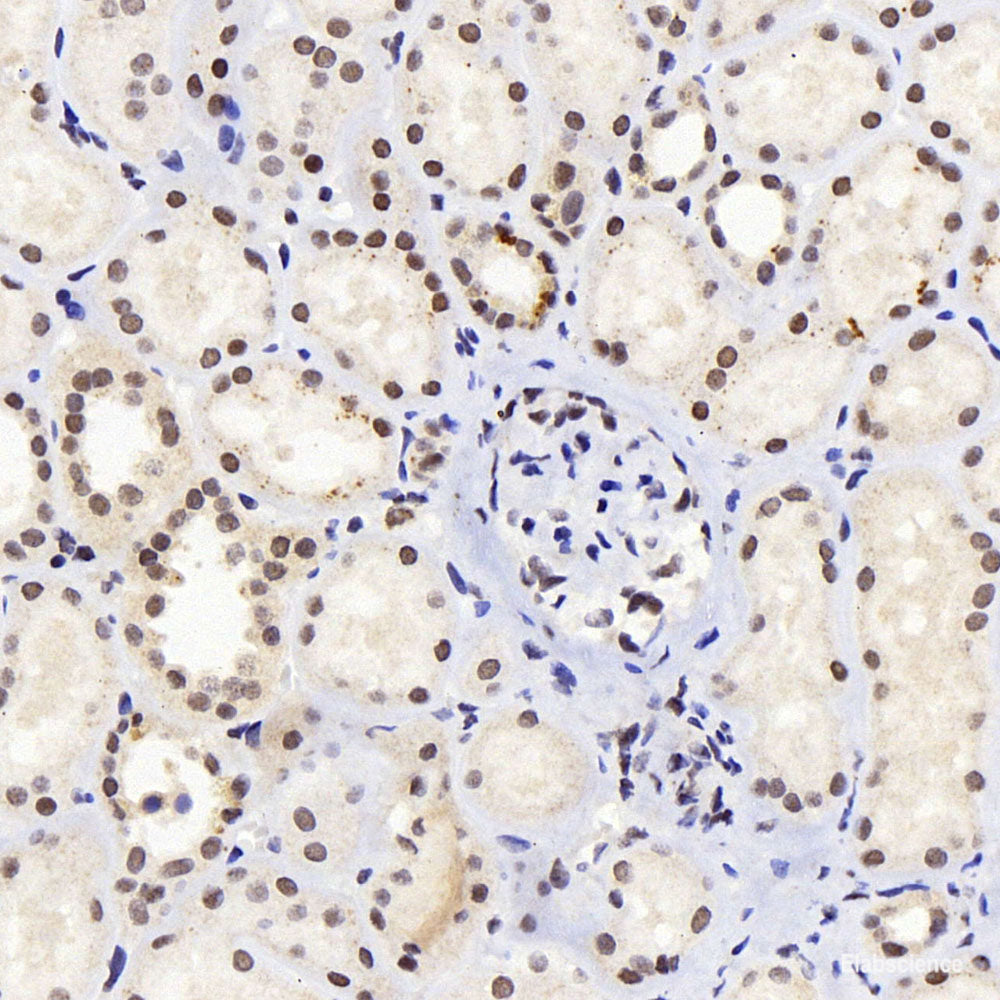 Immunohistochemistry of paraffin-embedded Mouse liver using N-Cadherin Polyclonal Antibody at dilution of 1:100 (40x lens).