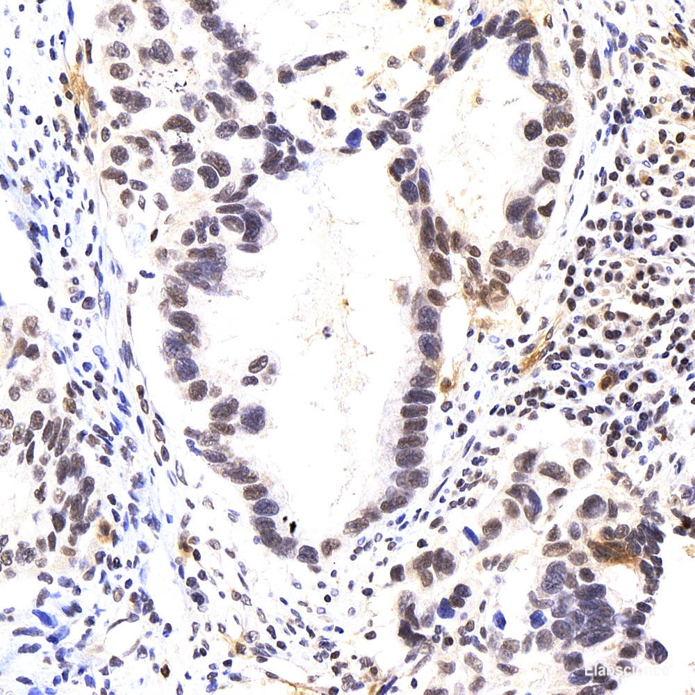 Immunofluorescence analysis of HeLa cells using XRCC1 Polyclonal Antibody at dilution of 1:100 (40x lens). Blue: DAPI for nuclear staining.
