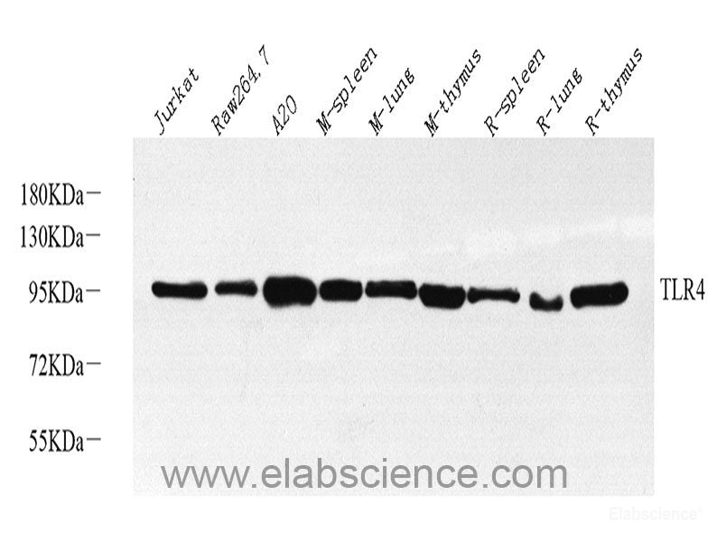 Western blot analysis of extracts of various cell lines using Fatty Acid Synthase Polyclonal Antibody at dilution of 1:1000.