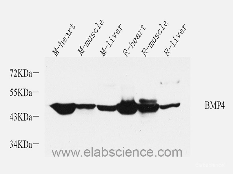Immunohistochemistry of paraffin-embedded Rat brain using TSC2 Polyclonal Antibody at dilution of 1:200 (40x lens).