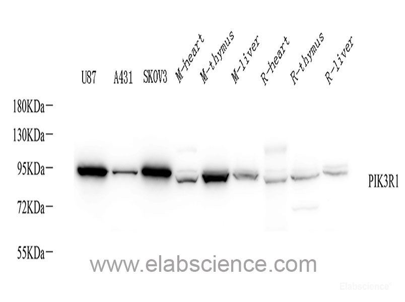 Immunohistochemistry of paraffin-embedded Mouse brain using MYCN Polyclonal Antibody