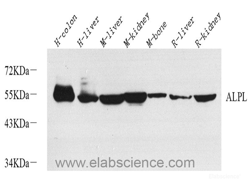 Western blot analysis of extracts of various cell lines using RELB Polyclonal Antibody at dilution of 1:1000.