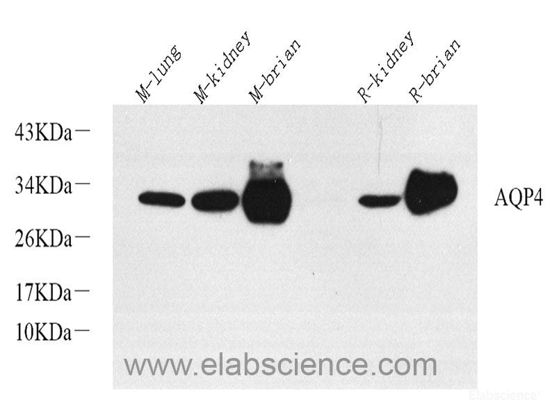 Western blot analysis of extracts of various cell lines using RIG-I / DDX58 Polyclonal Antibody at dilution of 1:500.