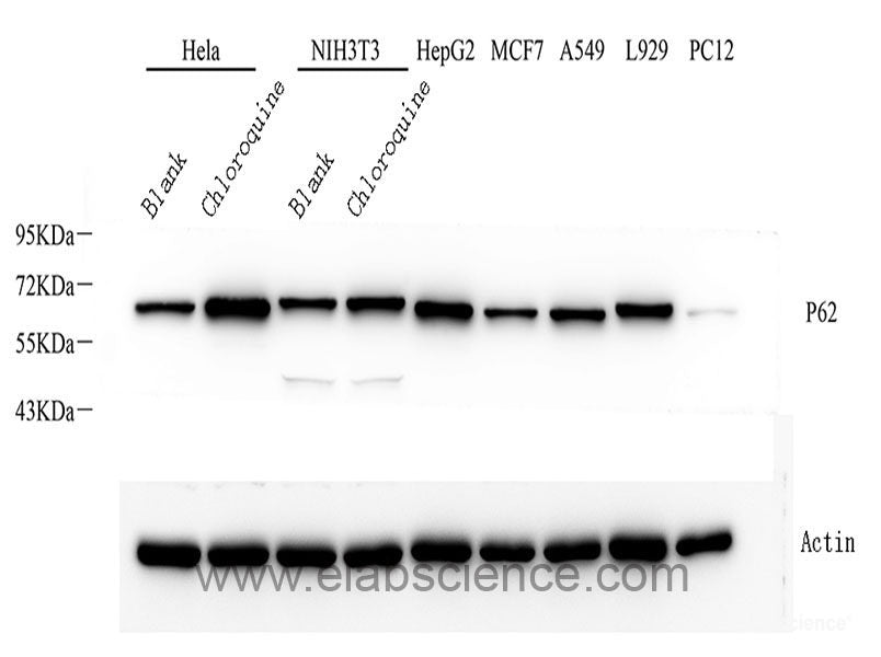 Immunohistochemistry of paraffin-embedded Human prostate using NEDD4 Polyclonal Antibody at dilution of 1:200 (40x lens).
