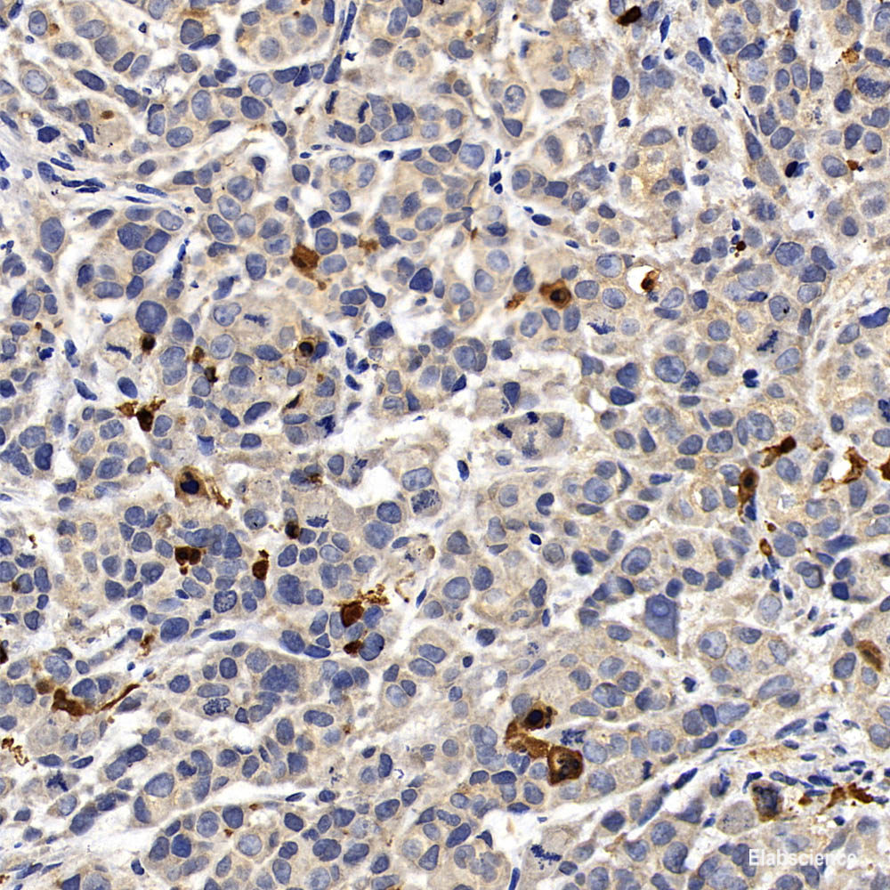 Immunohistochemistry of paraffin-embedded Rat kidney using HSPA9 Polyclonal Antibody at dilution of 1:100 (40x lens).