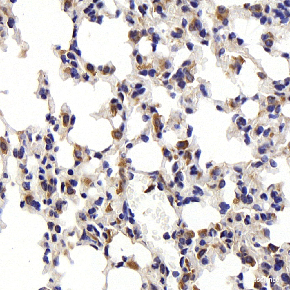 Immunohistochemistry of paraffin-embedded Human stomach using NOTCH2 Polyclonal Antibody at dilution of 1:100 (40x lens).