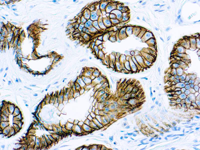 Epithelial Antigen